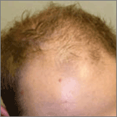 Restauration des cheveux Avant