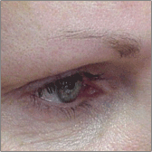 Permanent Makeup Before